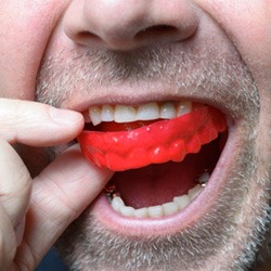  Man placing a mouthguard in his mouth
