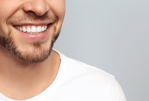 Man smiling after teeth whitening in Everett