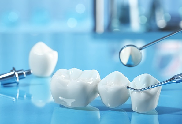 A customized dental bridge surrounded by dental instruments