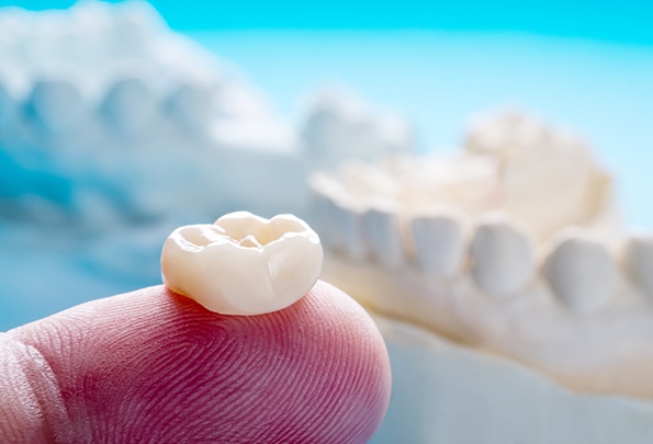 An up-close view of a tooth-colored dental crown sitting on a finger
