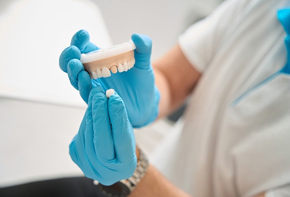 Dentist showing how a dental crown is put in place