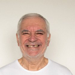 An older man with missing teeth 