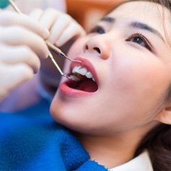 A woman getting a dental checkup