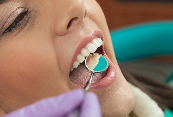 Closeup of patient during tooth-colored filling placement