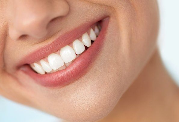 Closeup of flawless smile after full mouth reconstruction