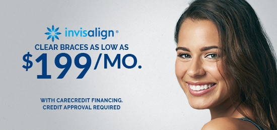 Invisalign special coupon