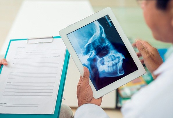 Dentist looking at digital skull and jawbone x-rays
