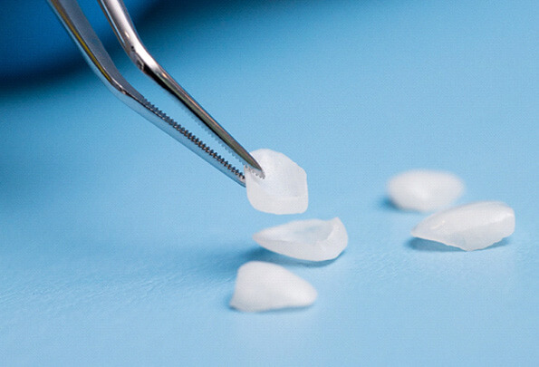 one veneer of several on a light blue surface being grabbed by tweezers
