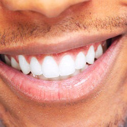 Closeup of a man smiling