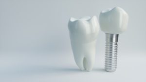 Dental implants against a white background.   