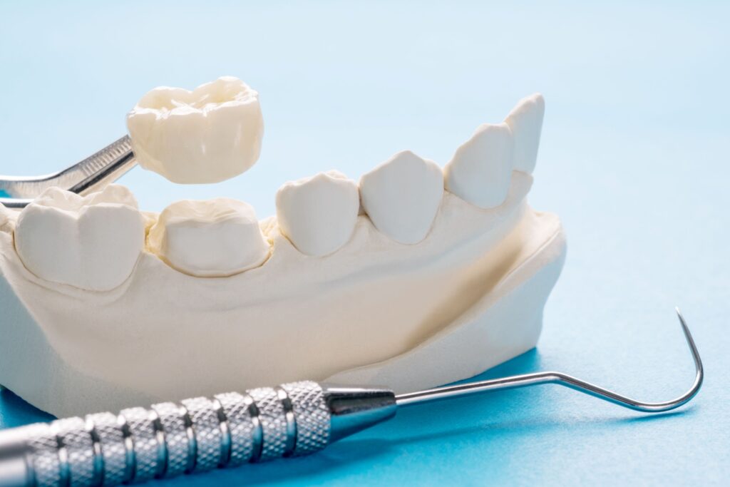 Dental instrument placing crown on model tooth